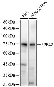 EPB42 Rabbit pAb