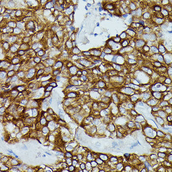 FCGR1B Rabbit pAb