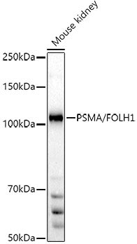 PSMA/FOLH1 Rabbit pAb