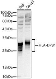HLA-DPB1 Rabbit pAb