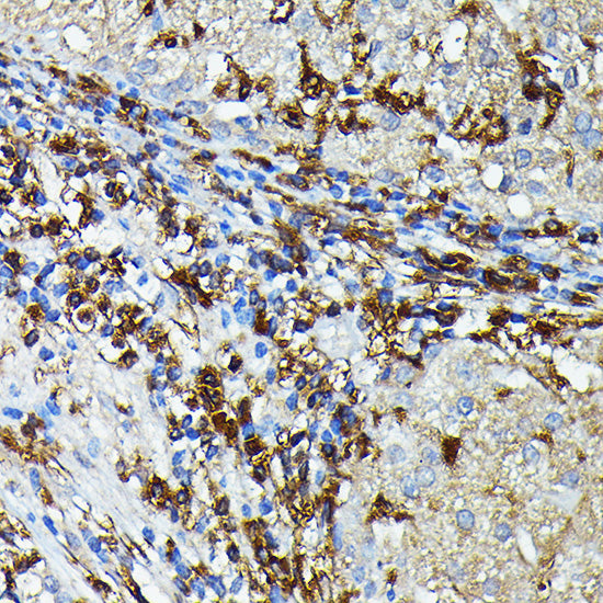 HLA-DPB1 Rabbit pAb