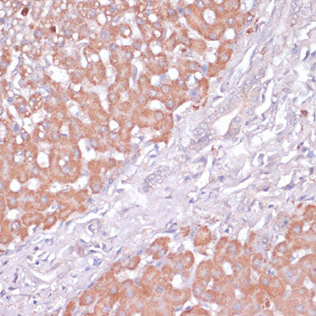 PI3 Kinase p85 beta Rabbit pAb
