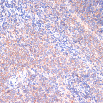 PI3 Kinase p85 beta Rabbit pAb