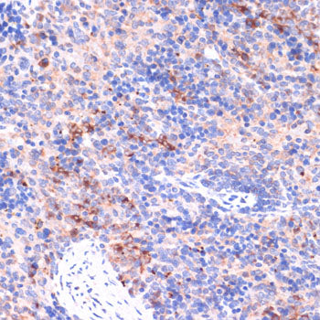 PI3 Kinase p85 beta Rabbit pAb