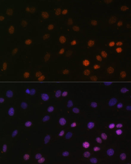MonoMethyl-Histone H2B-K5 Rabbit pAb
