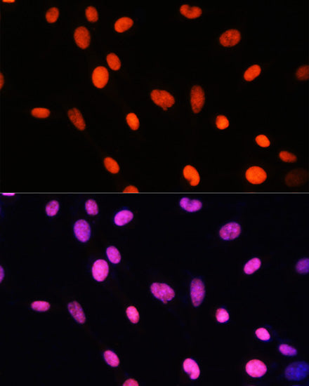 MonoMethyl-Histone H2B-K5 Rabbit pAb