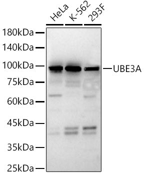 UBE3A Rabbit pAb
