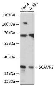 SCAMP2 Rabbit pAb