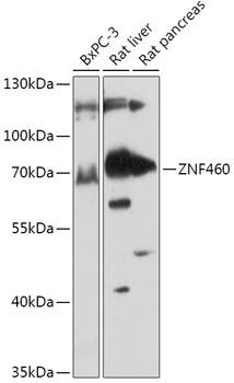 ZNF460 Rabbit pAb