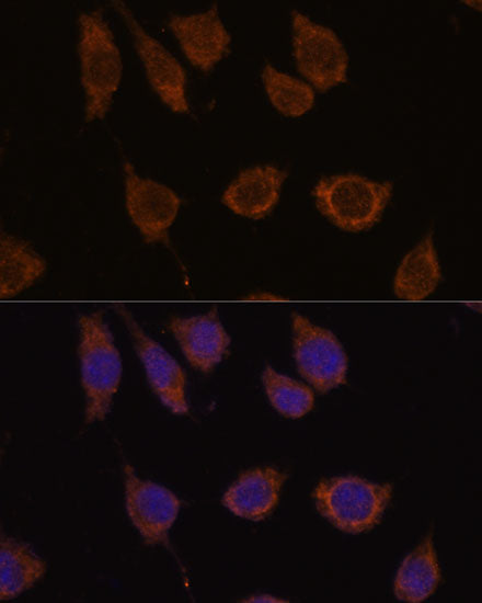 CA5B Rabbit pAb
