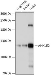 ANKLE2 Rabbit pAb