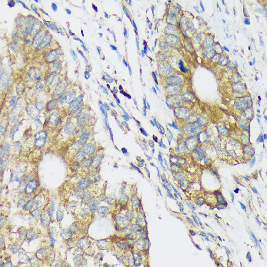 CLCC1 Rabbit pAb