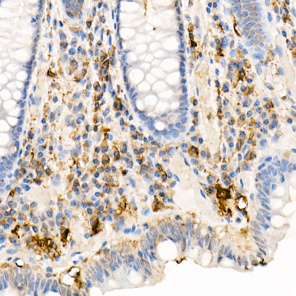 Ferritin Light Chain Rabbit pAb