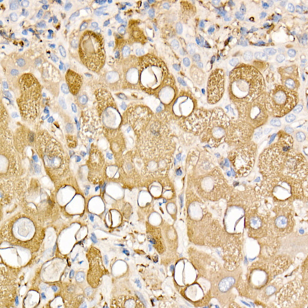 Ferritin Light Chain Rabbit pAb