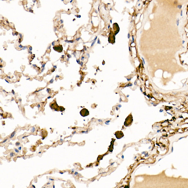 Ferritin Light Chain Rabbit pAb