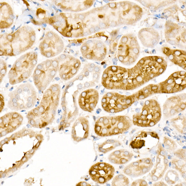 Ferritin Light Chain Rabbit pAb