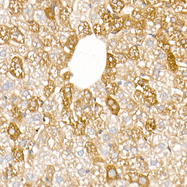 Ferritin Light Chain Rabbit pAb