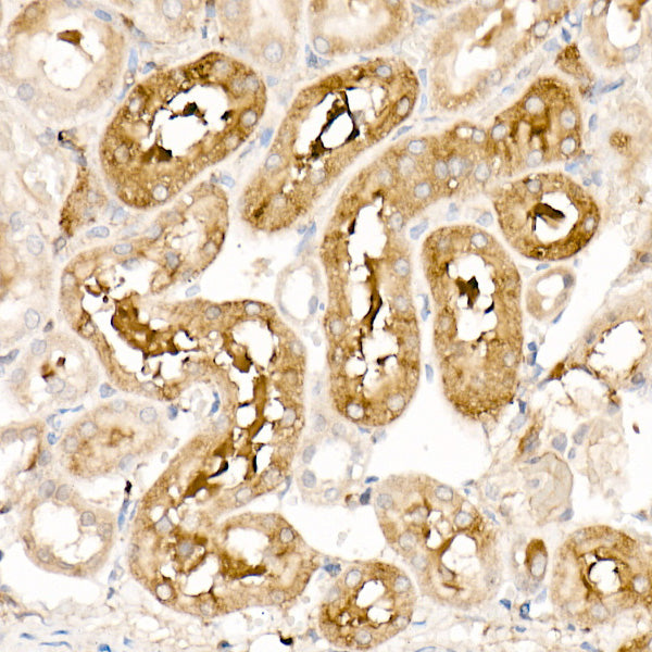 Ferritin Light Chain Rabbit pAb