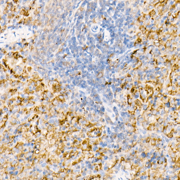Ferritin Light Chain Rabbit pAb