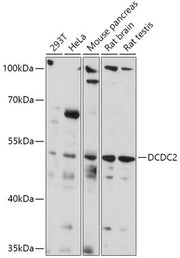 DCDC2 Rabbit pAb