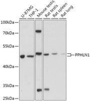 PPHLN1 Rabbit pAb