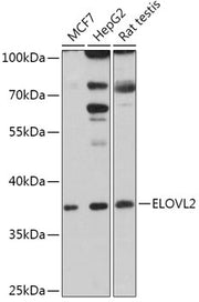 ELOVL2 Rabbit pAb