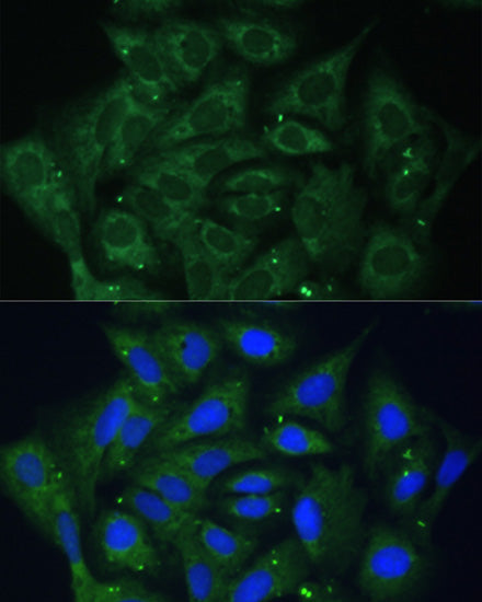 IGF2BP2/IMP2 Rabbit pAb