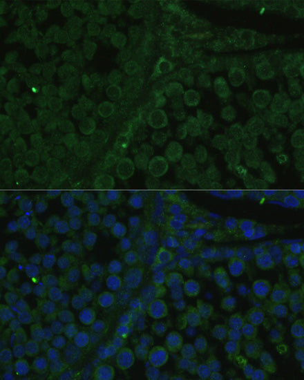 IGF2BP2/IMP2 Rabbit pAb