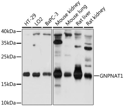 GNPNAT1 Rabbit pAb
