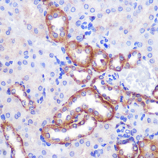 PIGM Rabbit pAb
