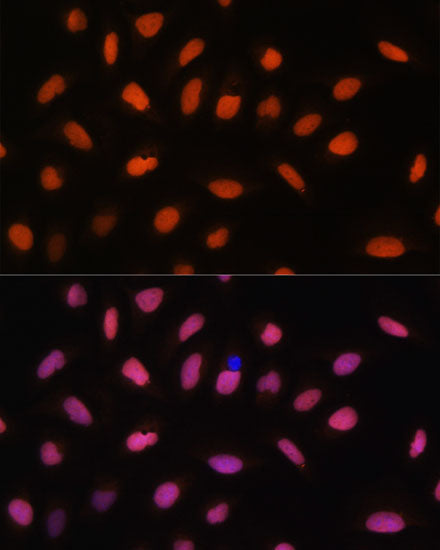 Histone H2AFV Rabbit pAb