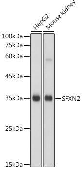 SFXN2 Rabbit pAb