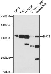 SMC2 Rabbit pAb