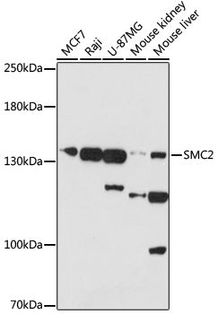 SMC2 Rabbit pAb