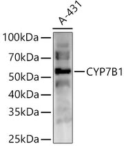 CYP7B1 Rabbit pAb