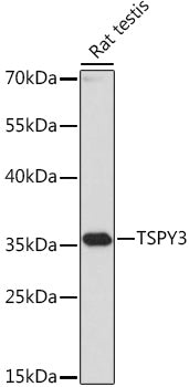 TSPY3 Rabbit pAb