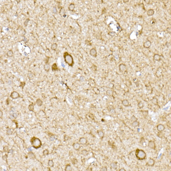 MTCO1 Rabbit pAb