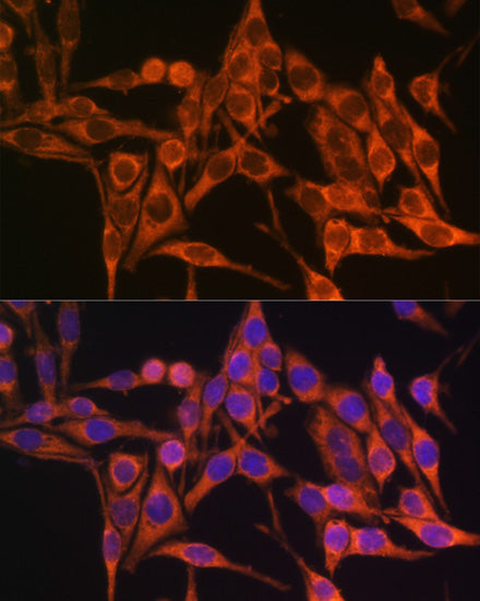 MT-ATP8 Rabbit pAb
