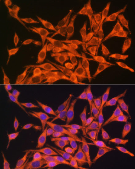 MT-ATP8 Rabbit pAb