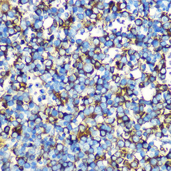 Alpha-Fetoprotein (AFP) Mouse mAb