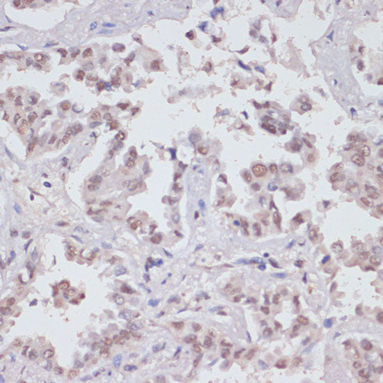 Asymmetric DiMethyl-Histone H3-R17 Rabbit pAb
