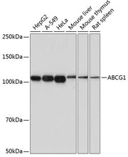 ABCG1 Rabbit mAb