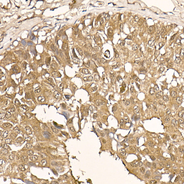 AKT1 Rabbit mAb
