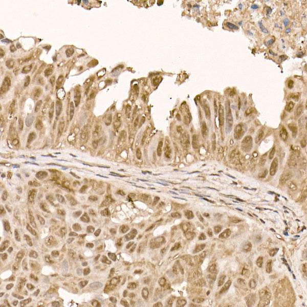 AKT1 Rabbit mAb