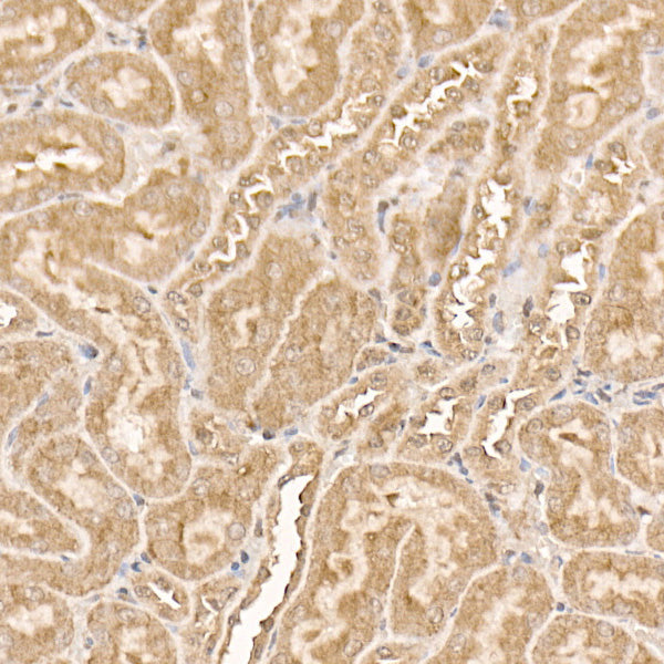AKT1 Rabbit mAb