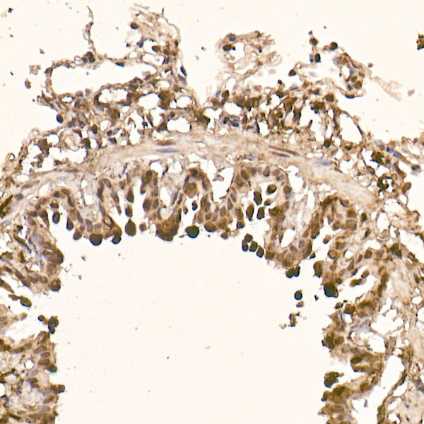 AKT1 Rabbit mAb