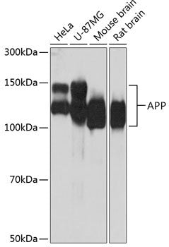 [KO Validated] APP Rabbit mAb