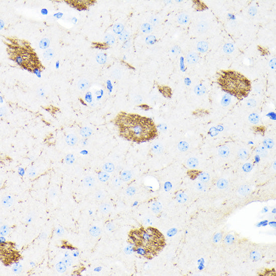 [KO Validated] APP Rabbit mAb