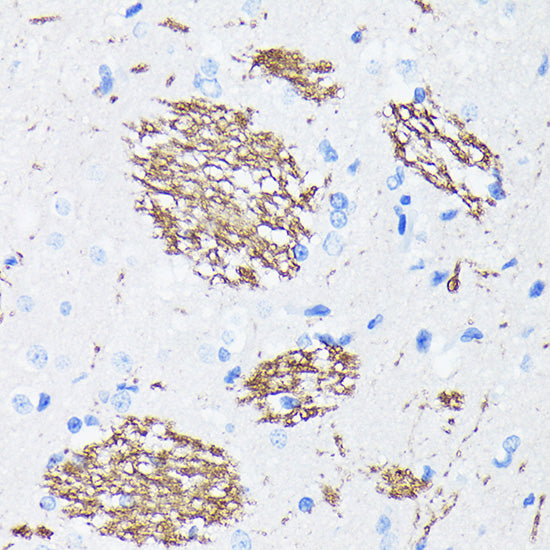 [KO Validated] APP Rabbit mAb