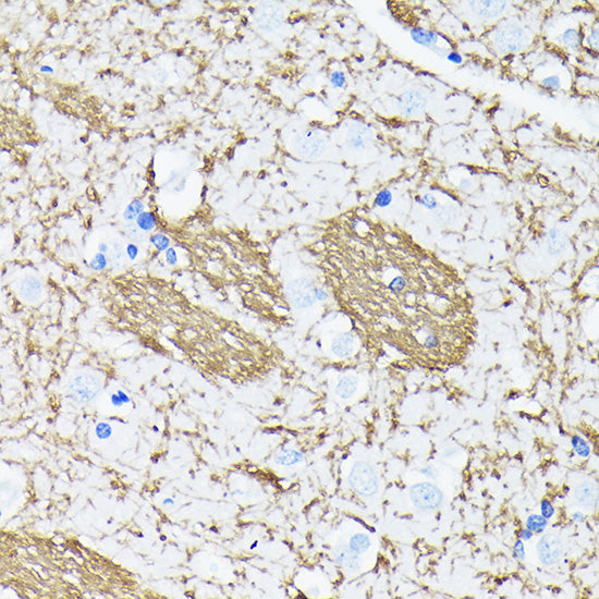 [KO Validated] APP Rabbit mAb